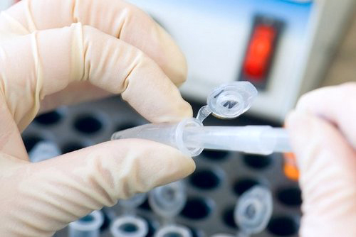 Биопсия простаты (биопсия предстательной железы) под наркозом в г. Краснодар